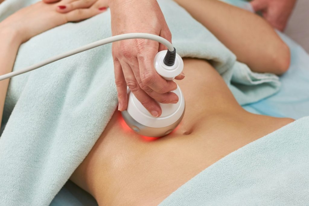 Radio frequency skin tightening, belly