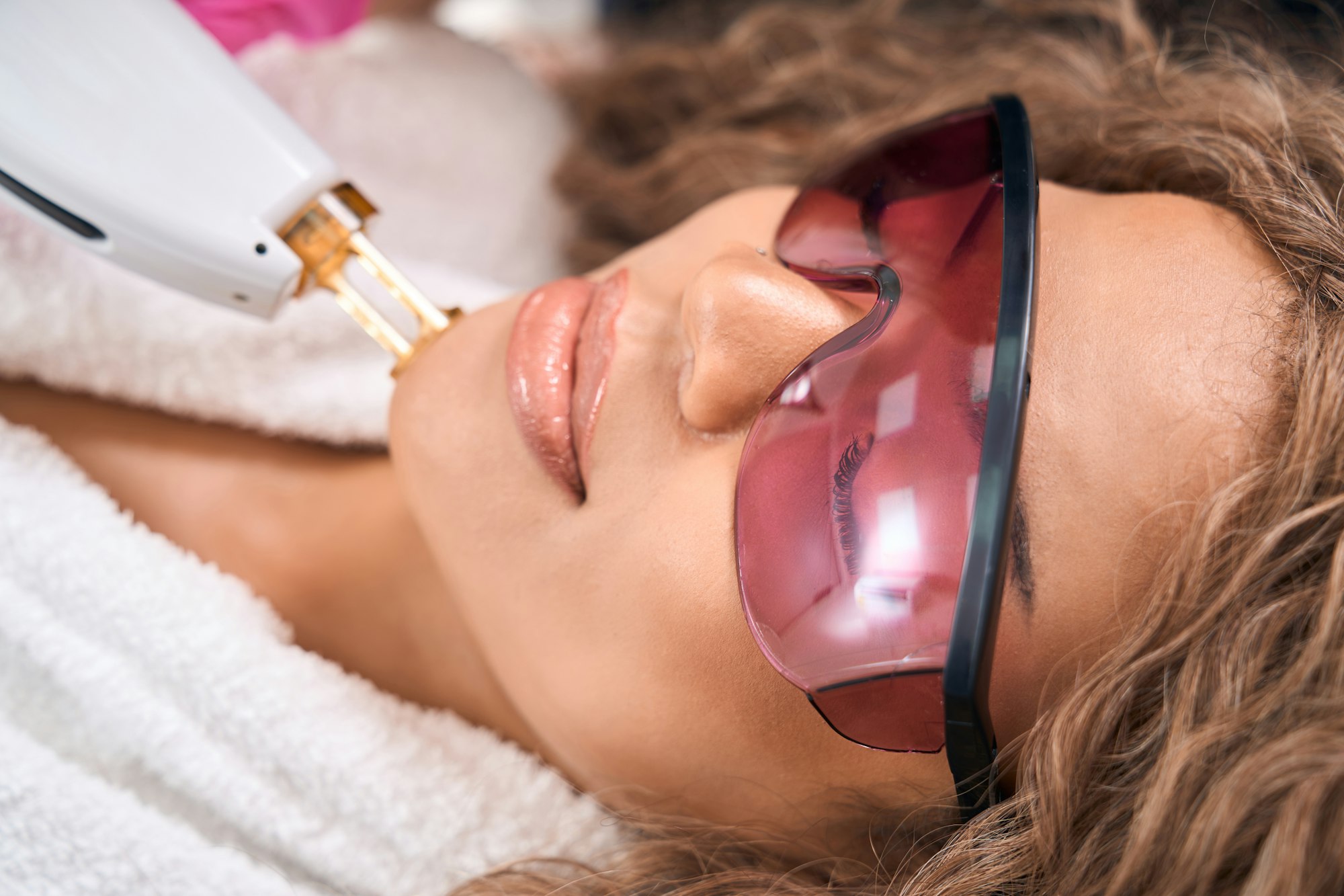 Procedure for laser hair removal from a female chin