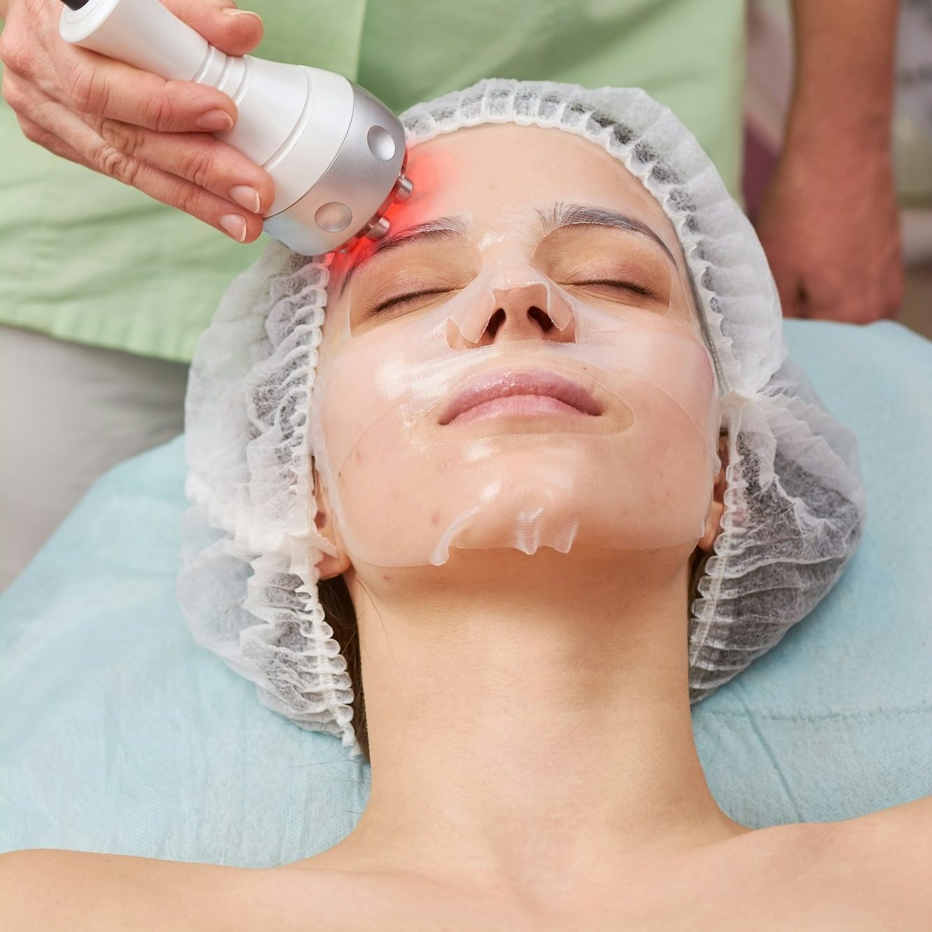 Radio Frequency Microneedling
